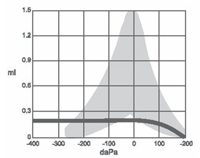 Flat Type B abnormal tympanogram